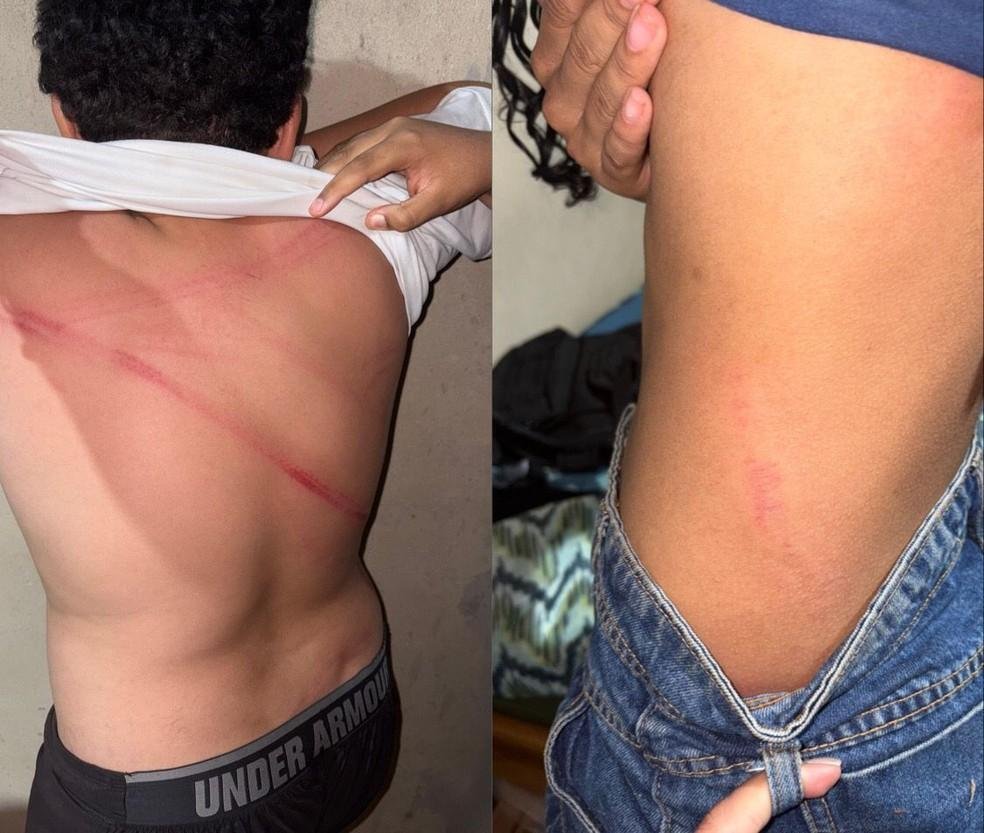 Homem é preso suspeito de espancar os dois filhos no Piauí; adolescentes apresentavam marcas