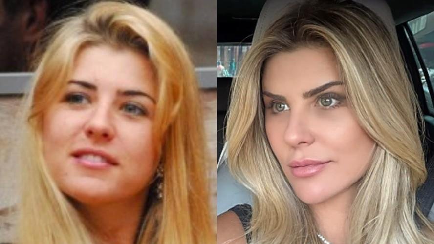 Íris Stefanelli aposta em lifting facial para visual natural; entenda a técnica com especialistas