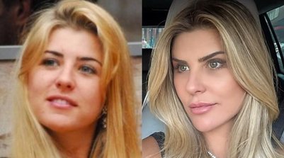 Íris Stefanelli aposta em lifting facial para visual natural; entenda a técnica com especialistas (Foto: Reprodução Globo/Instagram)