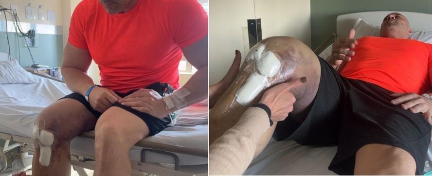 Daniel Silveira em sessão de fisioterapia após cirurgia na perna