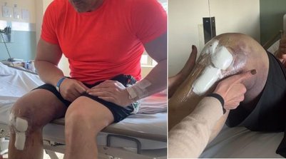 Daniel Silveira em sessão de fisioterapia após cirurgia na perna (Foto: Reprodução)