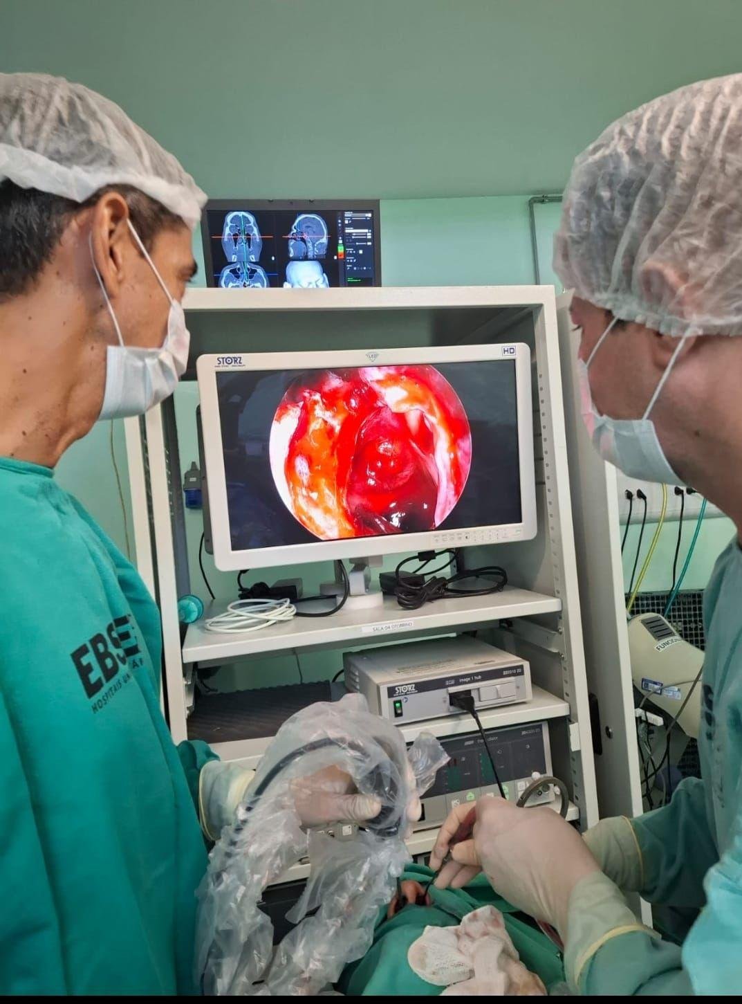 HU-UFPI realiza cirurgia de tumor cerebral com acesso pelo nariz
