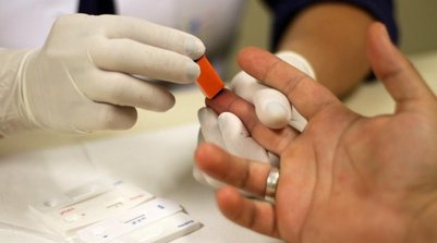 Centro de testagem para HIV no Distrito Federal (Foto: Rodrigo Nunes/Ministério da Saúde)